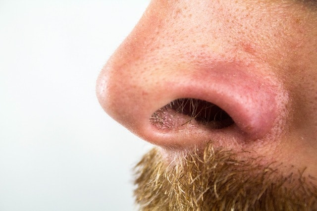 sebaceous filaments on a nose