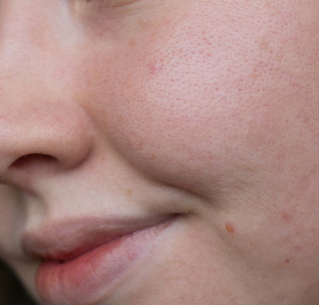 Pores and skin texture with no foundation