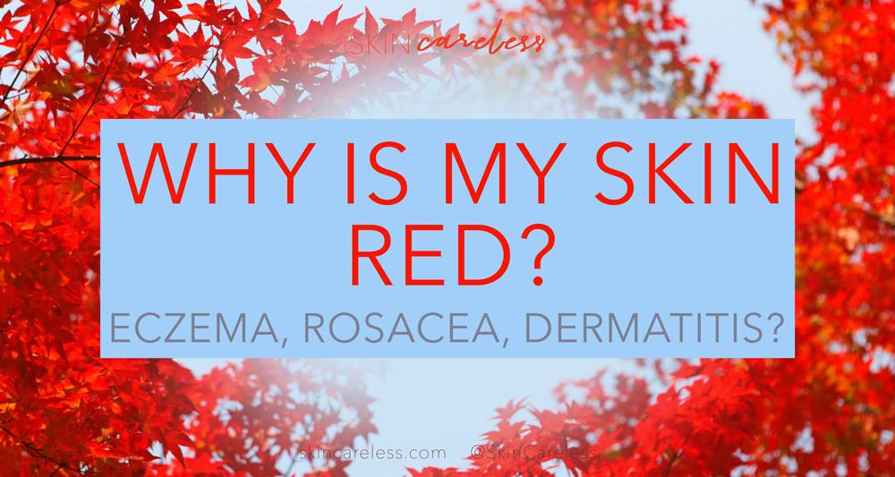 Why is my skin red? Eczema, rosacea and dermatitis.