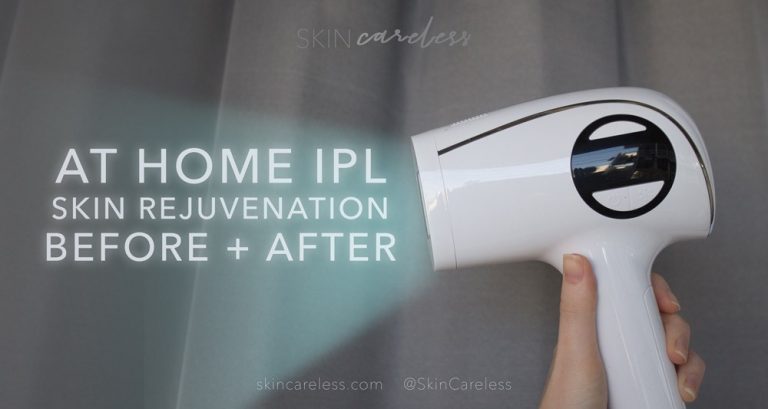 At home IPL skin rejuvenation before and after
