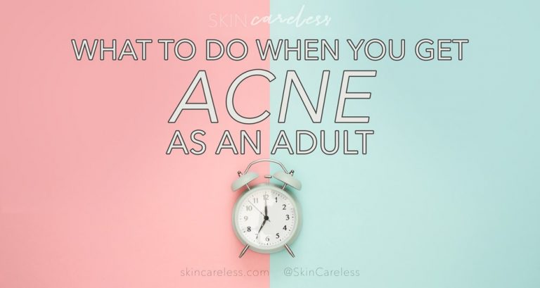 What to do when you get acne as an adult