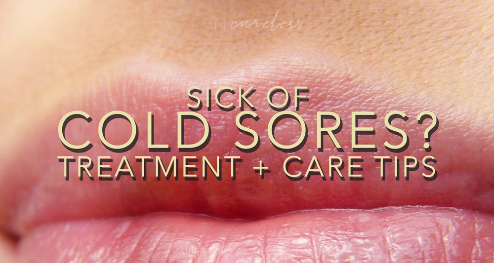 Sick of cold sores? Treatment and care tips