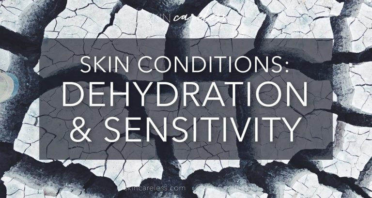 Skin conditions: dehydration & sensitivity
