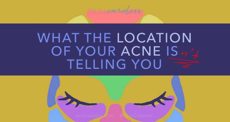 What the location of your acne isn't telling you