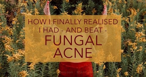 How I finally realised I had - and beat - fungal acne