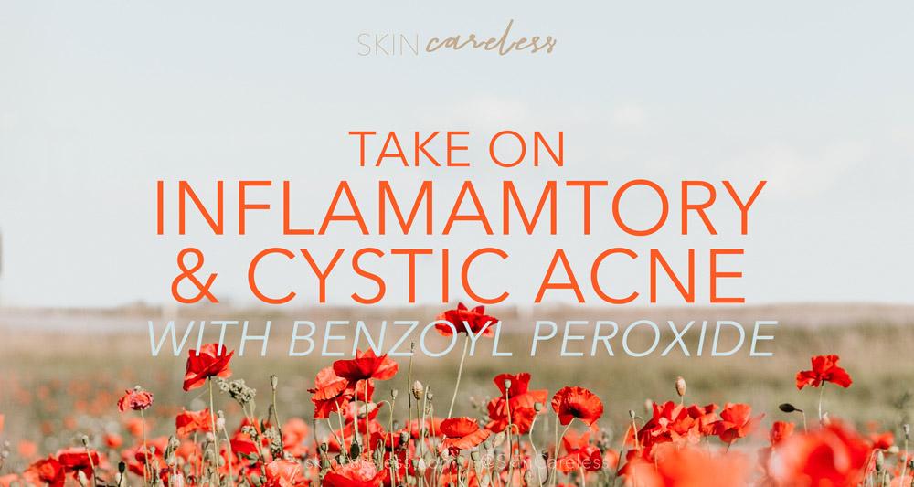 Take on inflammatory and cystic acne with benzoyl peroxide