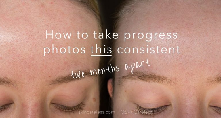 How to take progress photos this consistent