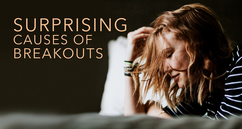 Surprising causes of breakouts