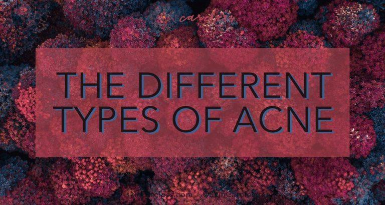 The different types of acne